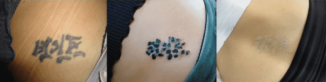 Skinial Poland Bożena Thomsen