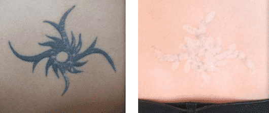 Skinial Poland Bożena Thomsen