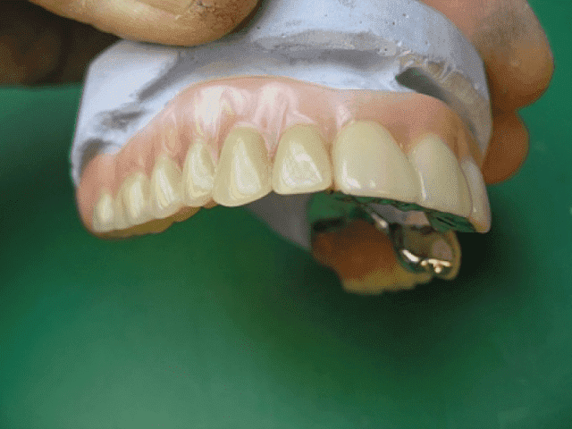 BŁAWAT REGINA . PRACOWNIA TECHNIK DENTYSTYCZNYCH, PROTETYKA.